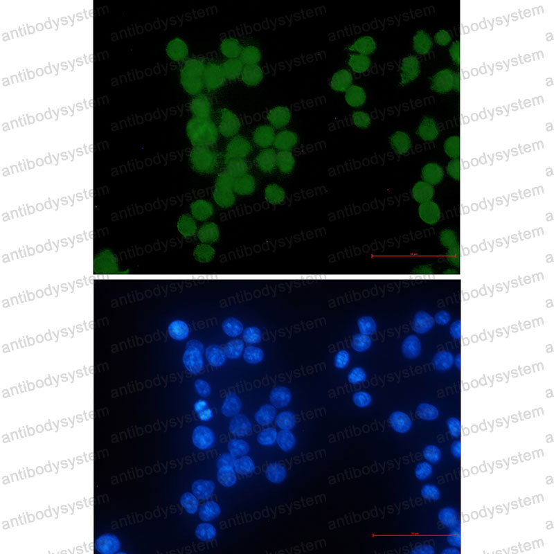Anti-HIPK2 Antibody (R2Q65)