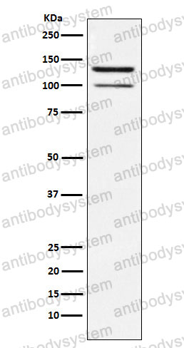 Anti-HIPK2 Antibody (R2Q64)