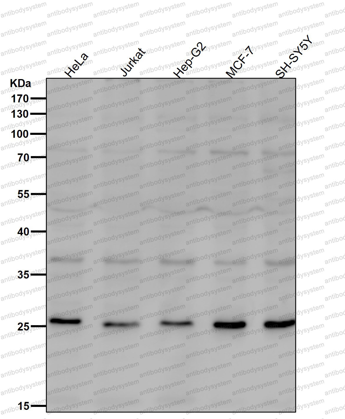 Anti-NEUROG2 Antibody (R2Q67)