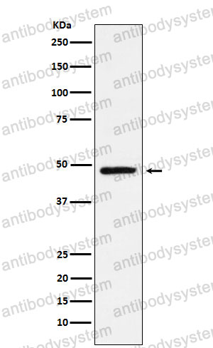 Anti-NR2E1 Antibody (R2Q68)