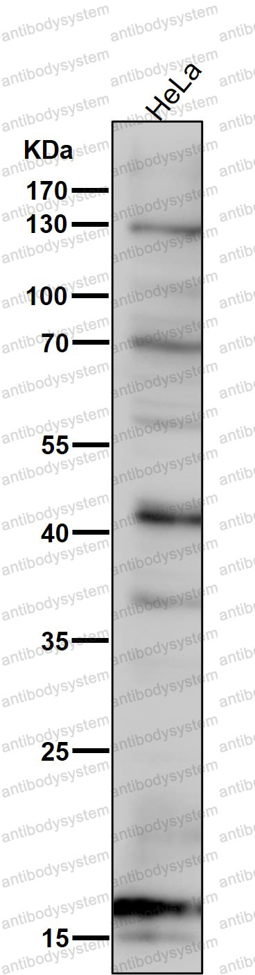 Anti-SDHC Antibody (R2Q69)