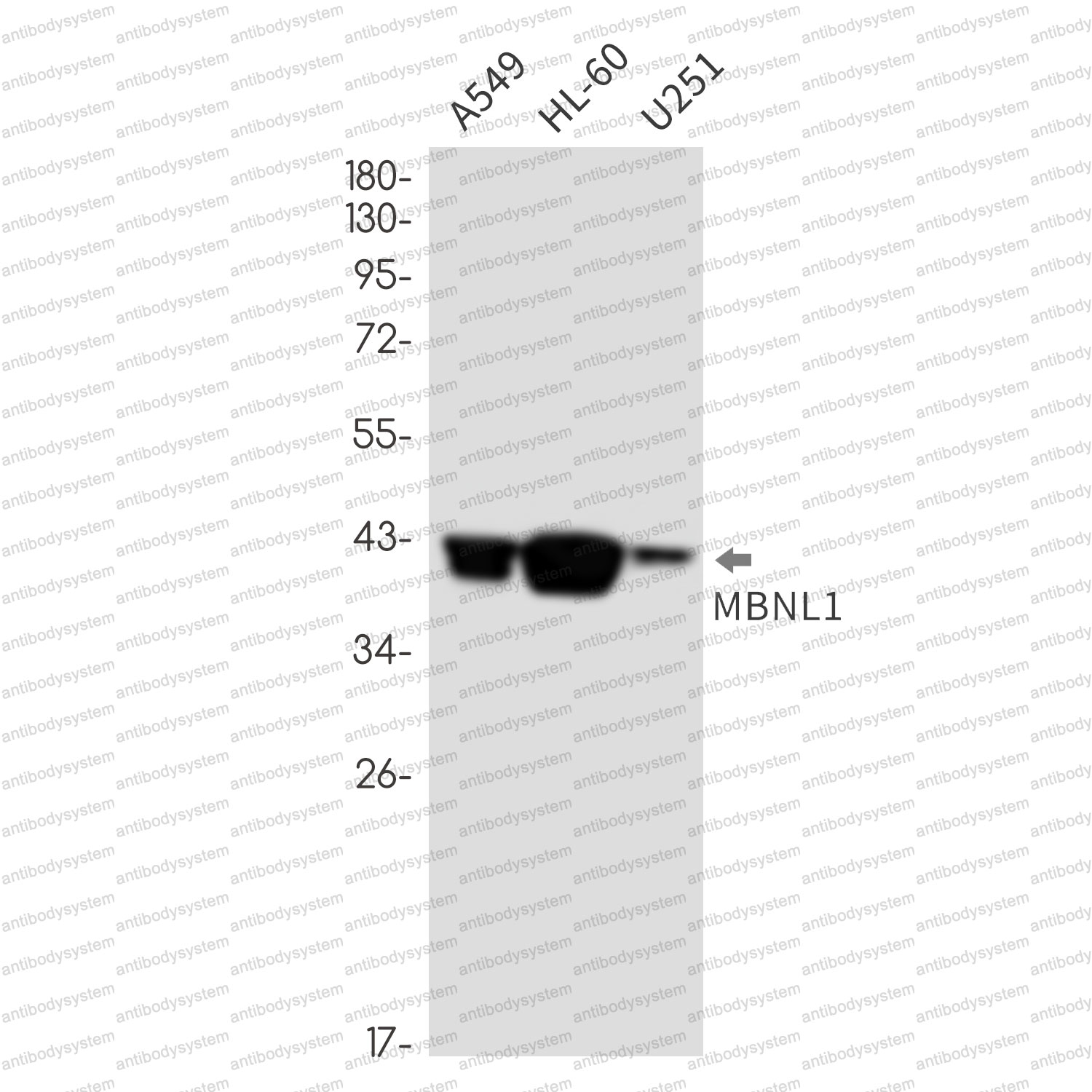 Anti-MBNL1 Antibody (R2Q71)