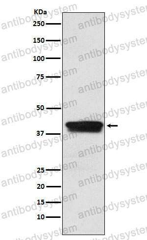 Anti-MBNL1 Antibody (R2Q70)