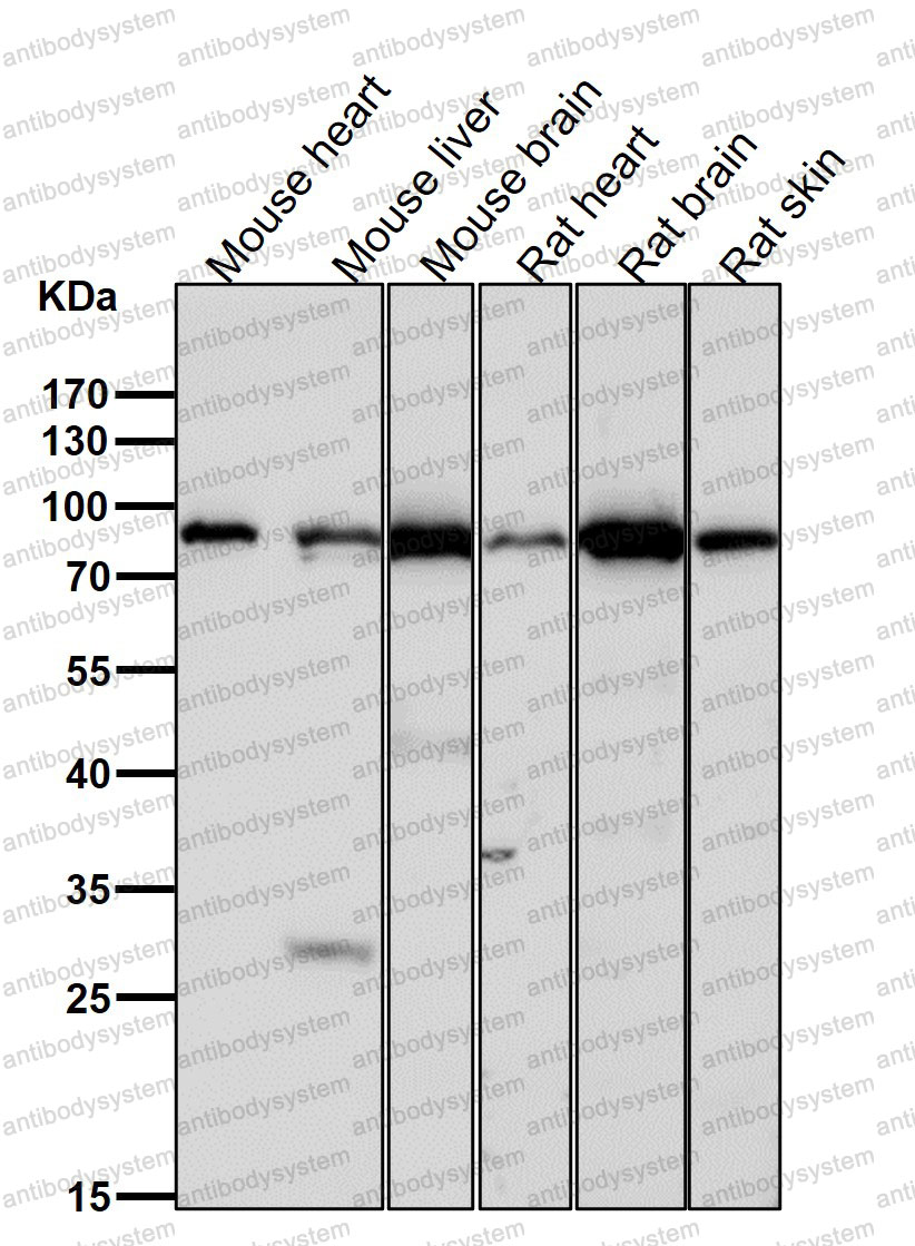 Anti-TNPO3 Antibody (R2Q75)