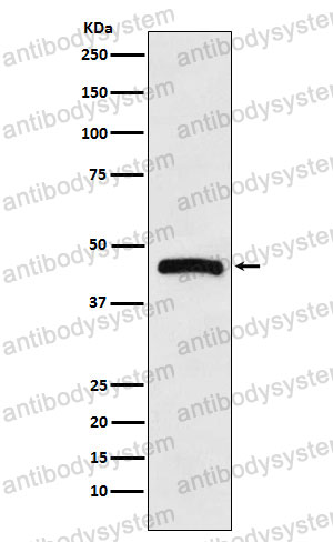 Anti-HRH3 Antibody (R2Q76)