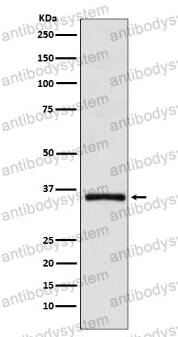 Anti-DMRT1 Antibody (R2Q78)