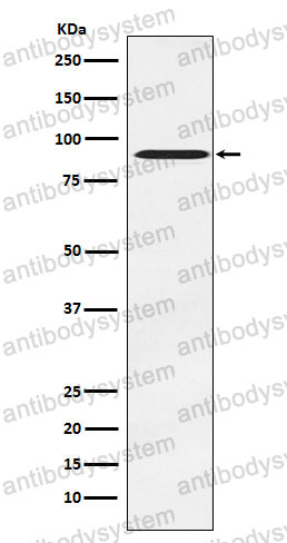 Anti-ATRIP Antibody (R2Q79)