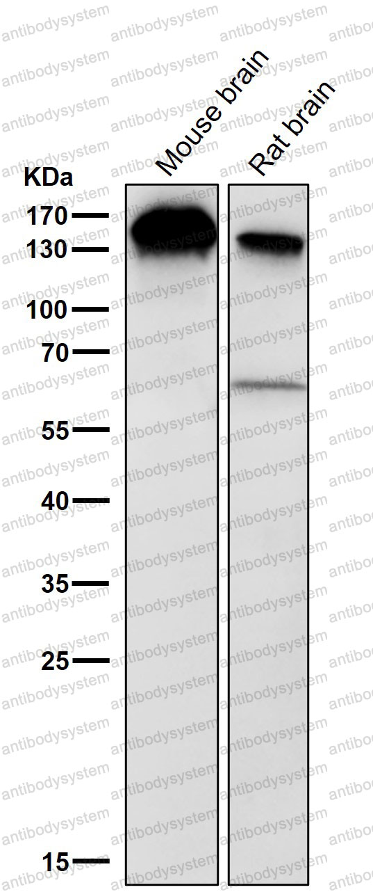 Anti-BCLAF1 Antibody (R2Q83)