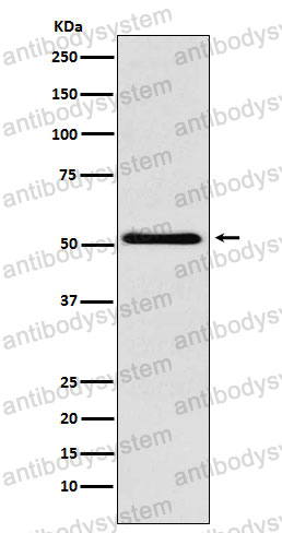 Anti-BAF57/SMARCE1 Antibody (R2Q85)
