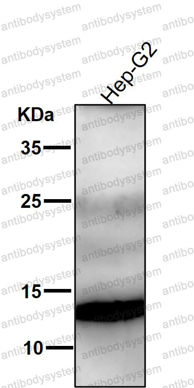 Anti-PSENEN Antibody (R2Q86)