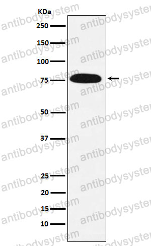 Anti-KHSRP Antibody (R2Q89)