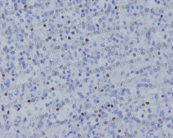 Anti-TBX21 Antibody (R2Q91)