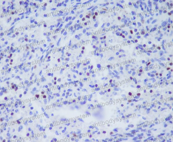 Anti-TBX21 Antibody (R2Q90)
