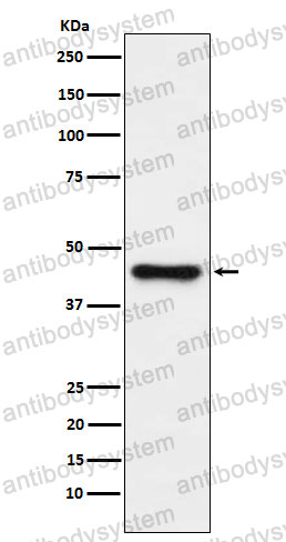 Anti-ABHD5 Antibody (R2Q92)