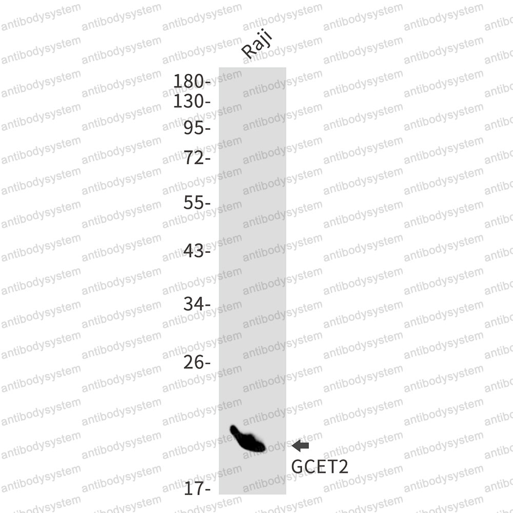 Anti-GCSAM Antibody (R2Q94)