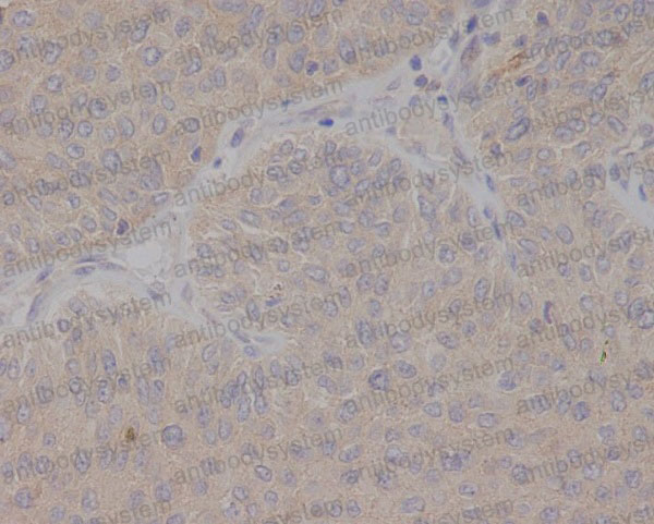 Anti-GCSAM Antibody (R2Q93)