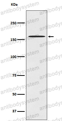 Anti-CLASP1 Antibody (R2Q95)