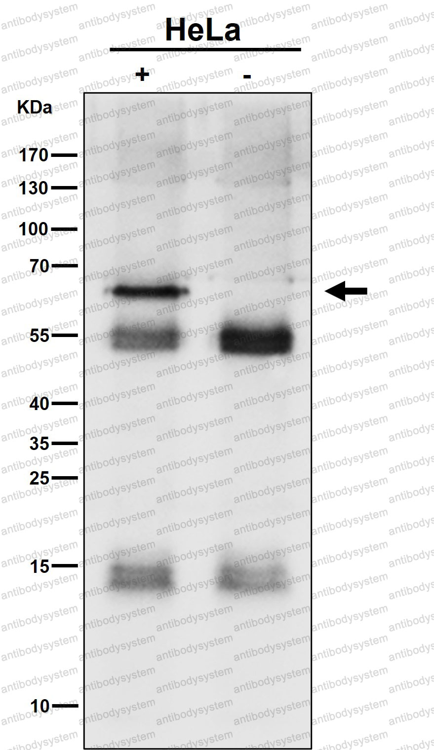 Anti-SYVN1/HRD1 Antibody (R2Q98)