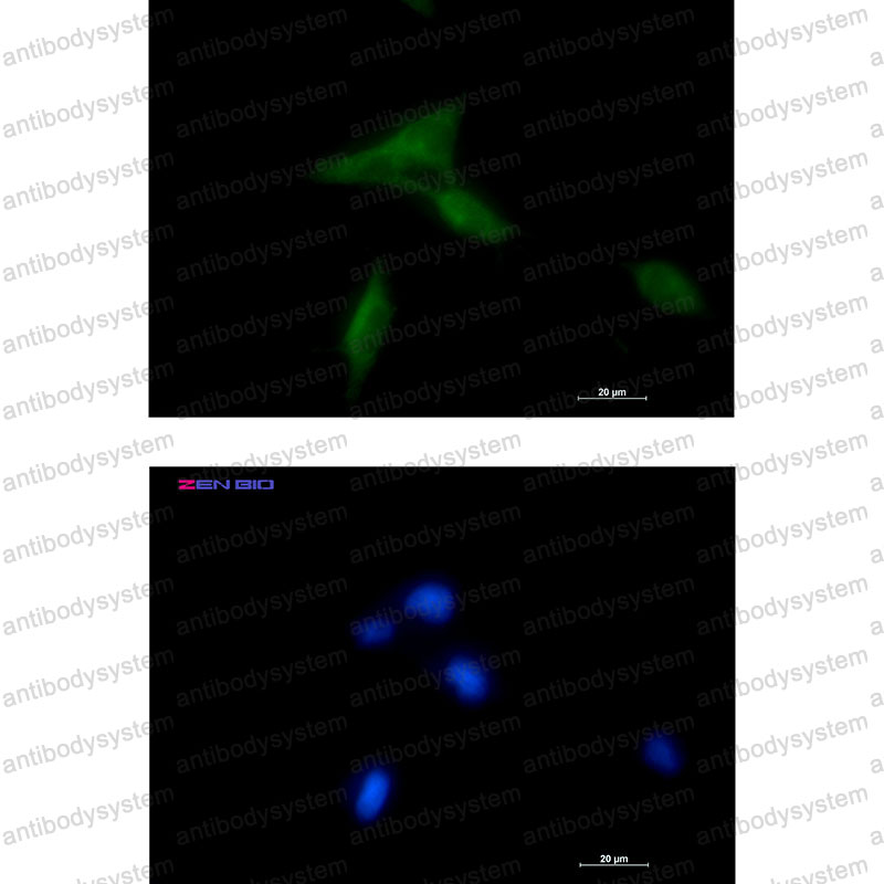 Anti-NDUFAF1 Antibody (R2R02)