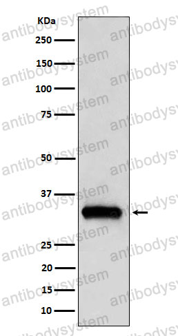 Anti-NDUFAF1 Antibody (R2Q99)