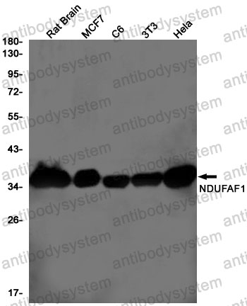 Anti-NDUFAF1 Antibody (R2R01)