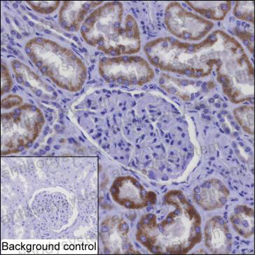 Anti-NDUFAF1 Antibody (R4A30)