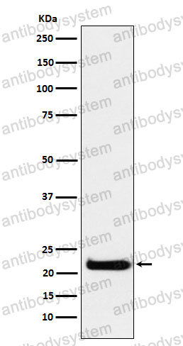 Anti-CEND1 Antibody (R2R04)