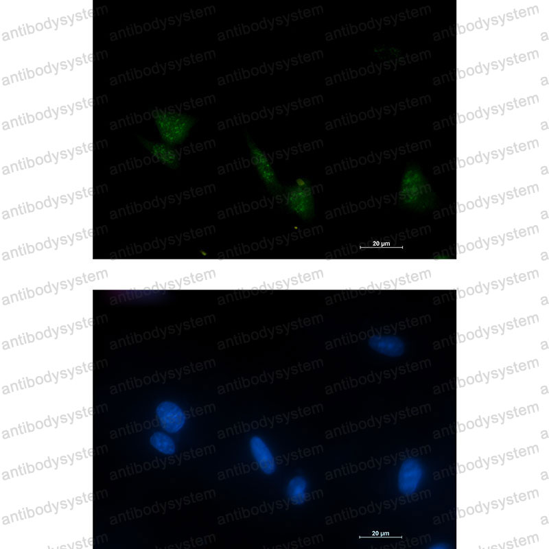 Anti-Phospho-RPS6KA6/RSK4 (Ser232) Antibody (R2R06)