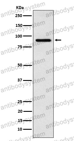 Anti-RPS6KA6 Antibody (R2R05)