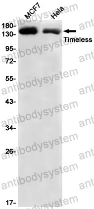 Anti-TIMELESS Antibody (R2R08)