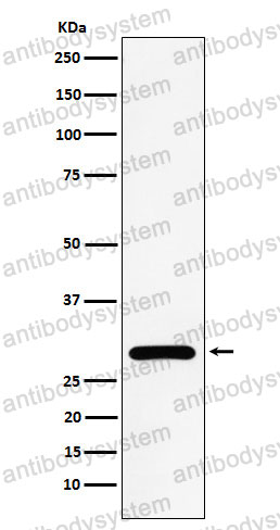 Anti-NEK6 Antibody (R2R12)