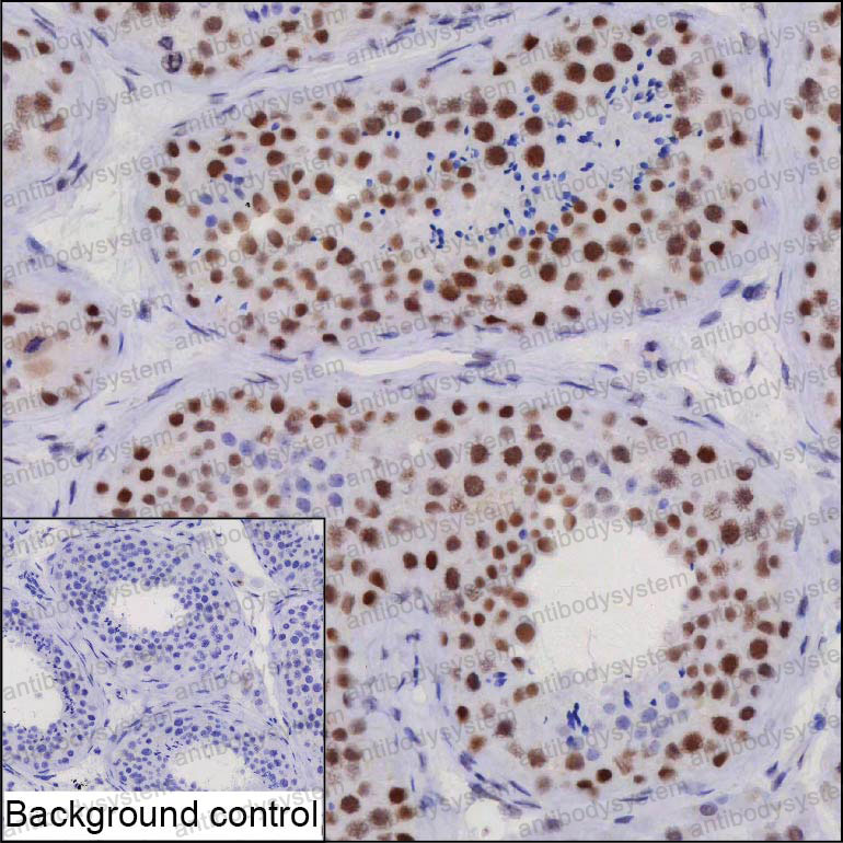Anti-WAPL Antibody (R4A31)
