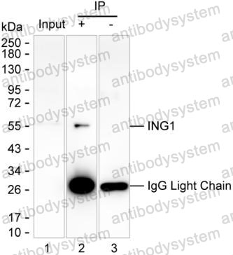 Anti-ING1 Antibody (R4A34)