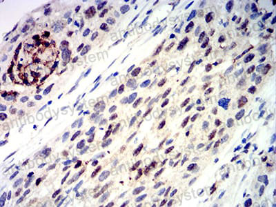 Anti-TFAP2C Antibody (R4A36)