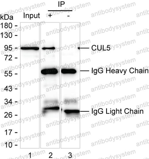 Anti-CUL5 Antibody (R4A43)