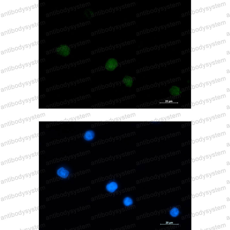 Anti-LGALS14 Antibody (R2S55)