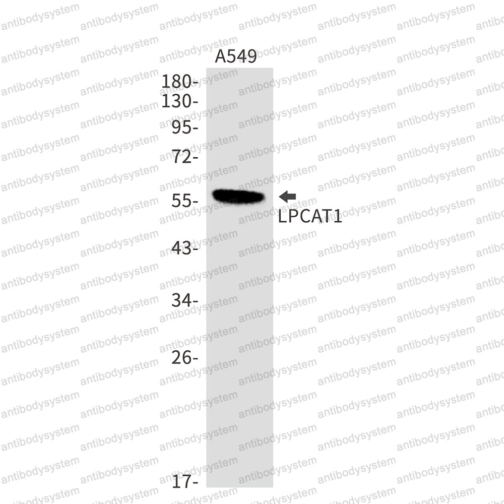 Anti-LPCAT1 Antibody (R2S56)