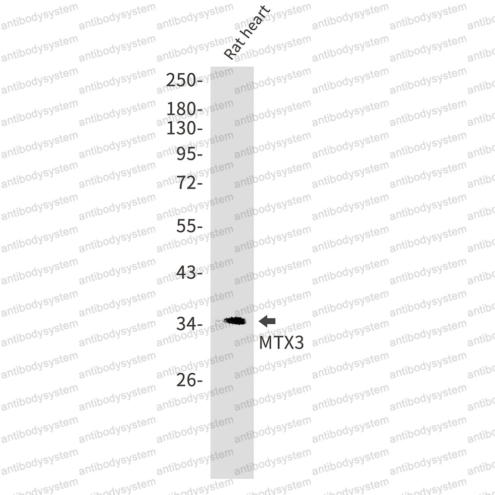 Anti-MTX3 Antibody (R2S58)