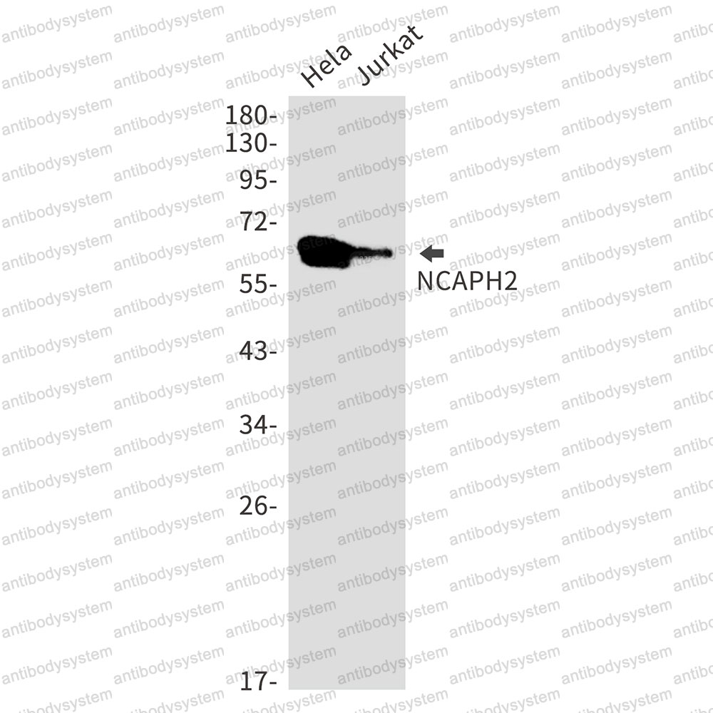 Anti-NCAPH2 Antibody (R2S59)