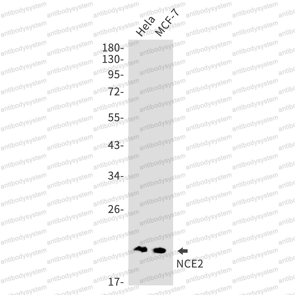 Anti-UBE2F Antibody (R2S60)
