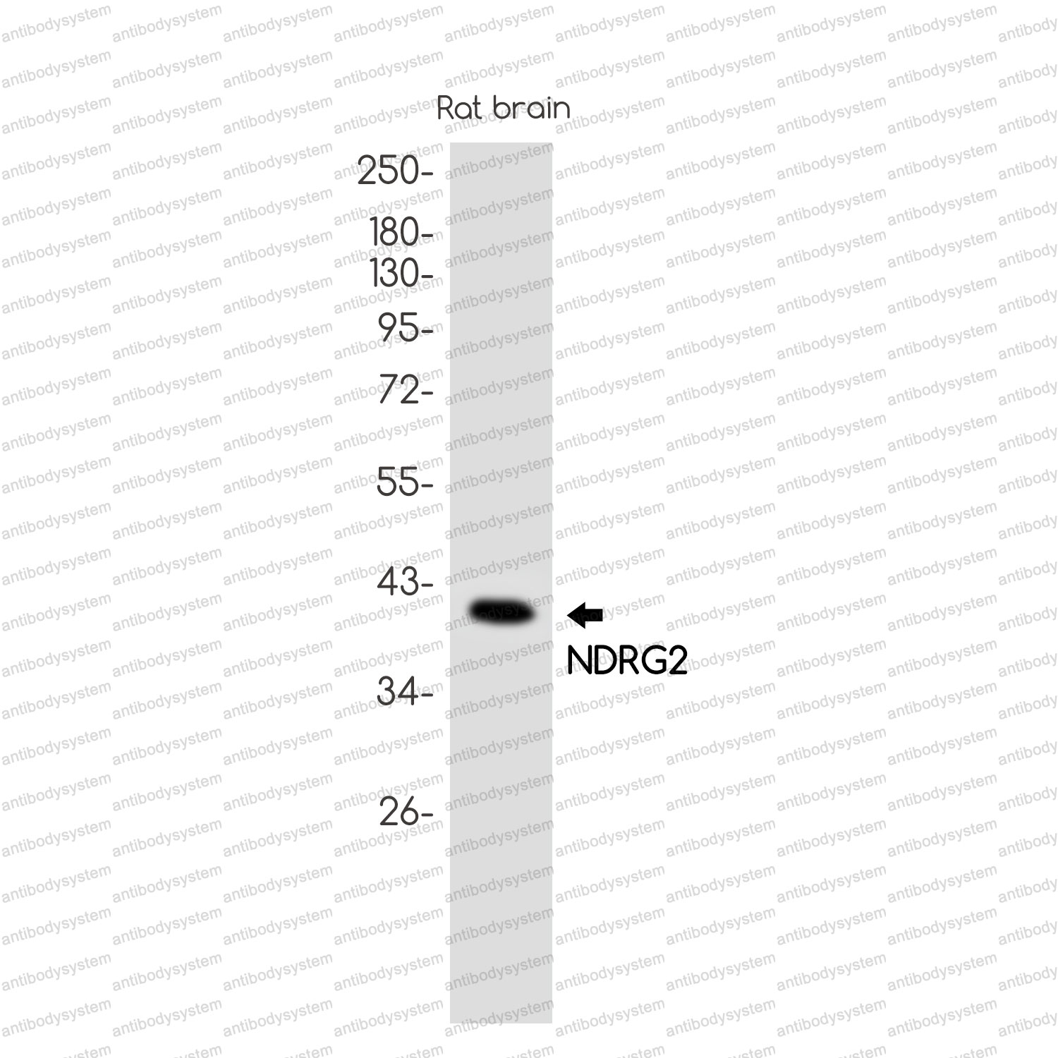 Anti-NDRG2 Antibody (R2S61)