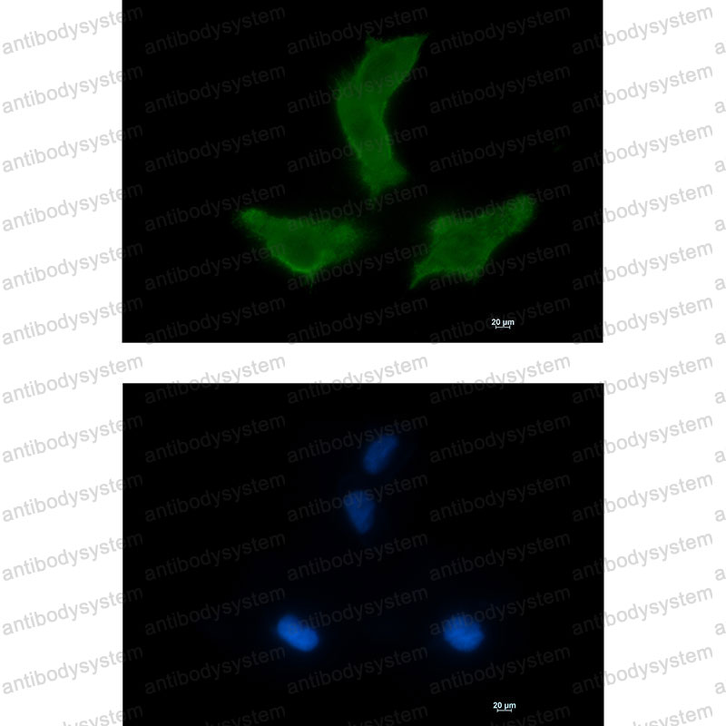 Anti-NEK9 Antibody (R2S63)