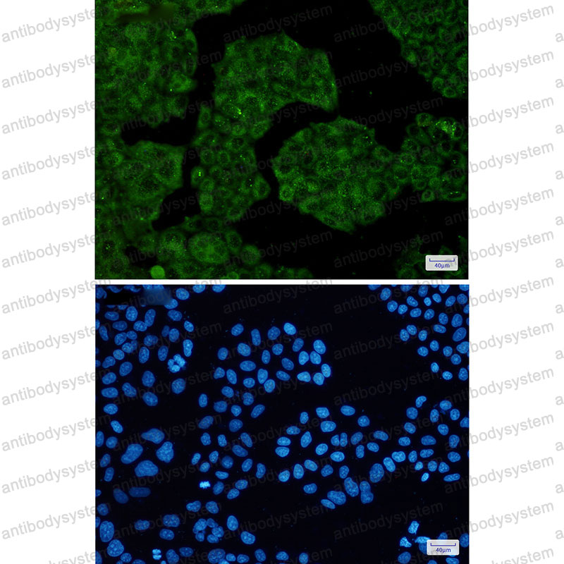 Anti-NUDT9 Antibody (R2S67)