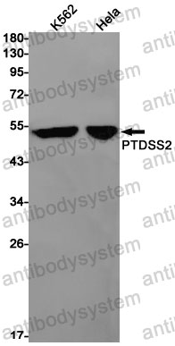 Anti-PTDSS2 Antibody (R2S69)