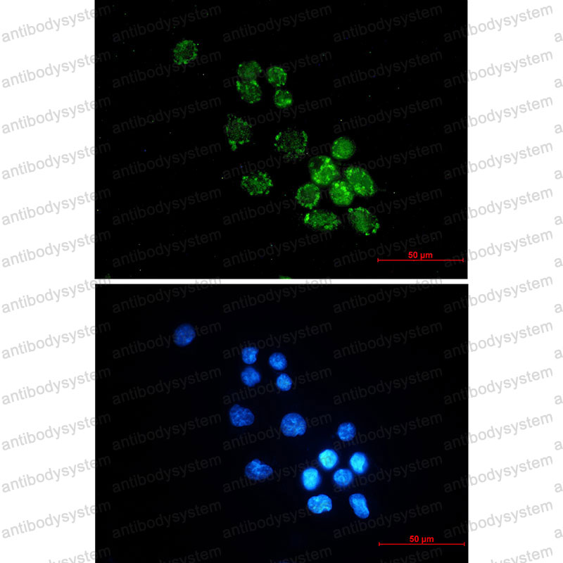 Anti-PUS1 Antibody (R2S70)