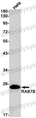 Anti-RAB7B Antibody (R2S71)