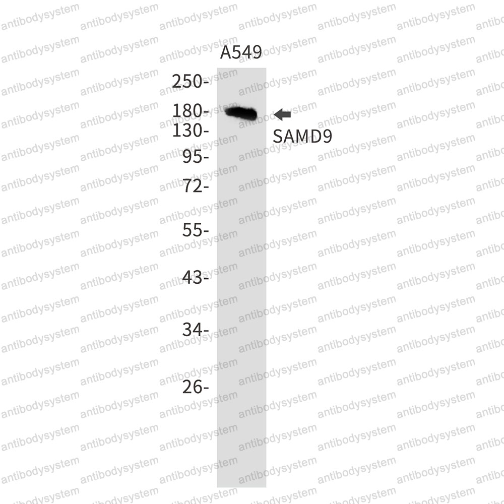 Anti-SAMD9 Antibody (R2S72)