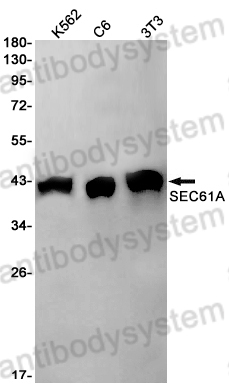 Anti-SEC61A2 Antibody (R2S74)