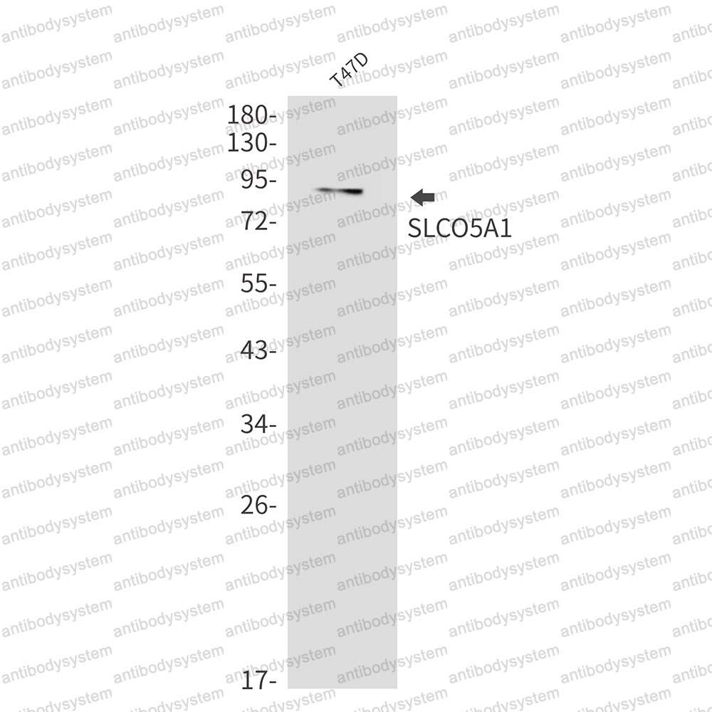Anti-SLCO5A1 Antibody (R2S75)
