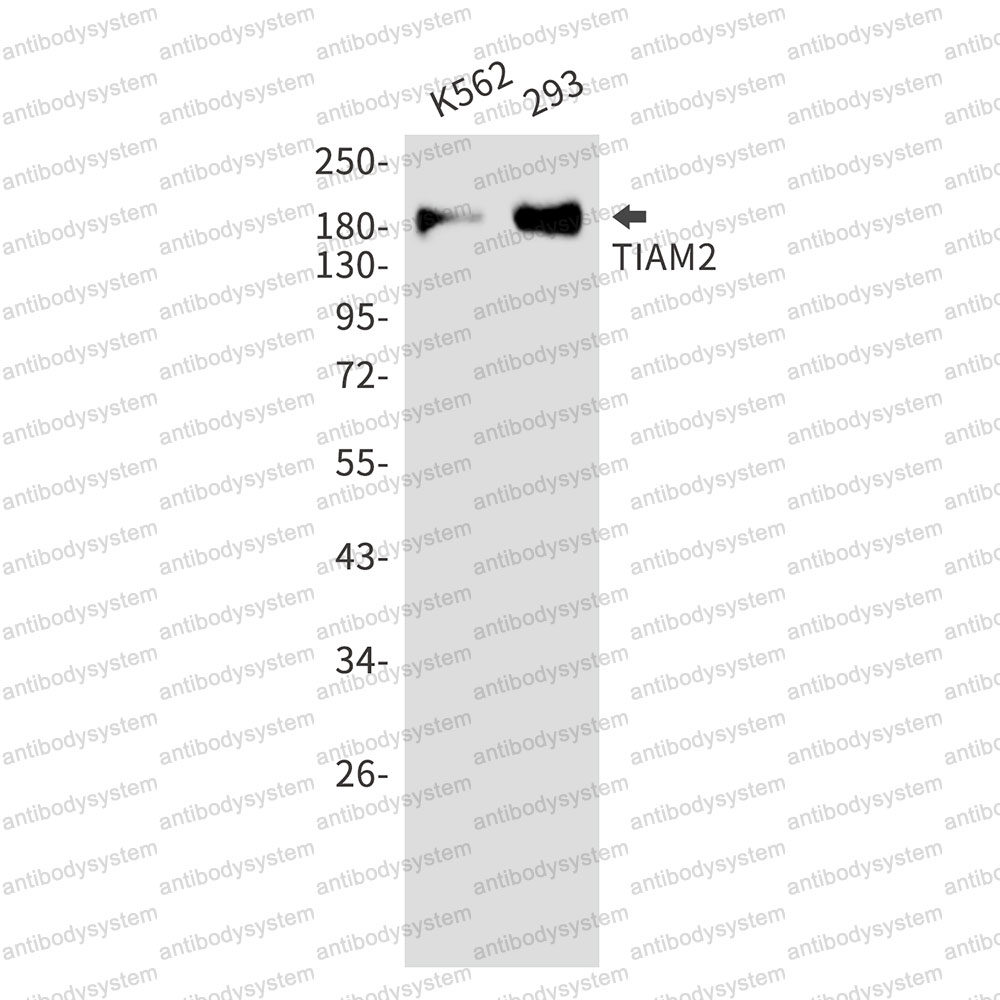 Anti-TIAM2 Antibody (R2S76)